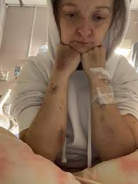 Haven't posted lately. Been in hospital twice lately. Total sixteen days.  Fighing MDS cancer, having to take blood transfusions. having lung problem,  a virus and have lost over 20 lbs. Thanks for