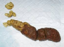 From not chewing enough to high motility, here's why undigested food shows up in stool. My Lily Still Not Digesting Food Warning Graphic Pic Maltese Dogs Forum Spoiled Maltese Forums