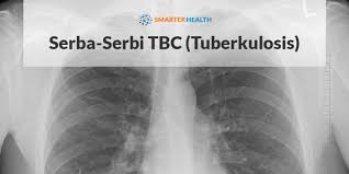Mycobacterium tuberculosis h37rv download sequences in fasta format for genome, protein like other closely related actinomycetales, such as nocardia and corynebacterium, mycobacteria have unusually high more.genomic dna gc content. Gejala Tbc Tuberkulosis Penyebab Biaya Berobat Dokter Smarter Health