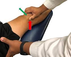 Image result for Patella Mobility Test