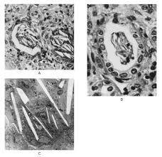 Image result for Indinavir