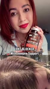 #dht #dhtblocker #hair #healthyhair #tiktokshop #paratii