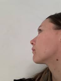 Surgery Now Reviews 2025