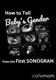 How far along do have to be to know the baby's gender? Pin On Pregnancy