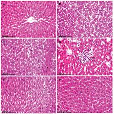 Full Text Pomegranate Juice Diminishes The Mitochondria