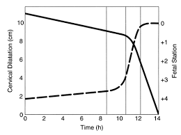 Cervical Dilation Effacement Station Chart