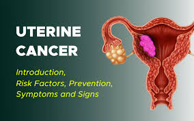 Imaging tests show pictures of the inside of the body. Uterine Cancer Surgmedia