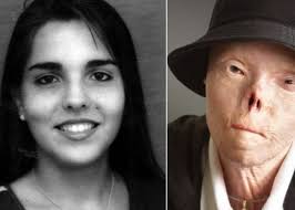 🚨Please read🚨 ¡Gracias! ❤️🇵🇷🤙🏼 Alelí Medina Suárez, is a young 13  year old “Isabelina”, who started surfing at an early age. She is  completely blind in her left eye and has partial