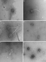 Trabalha com jornalismo de dados e acredita na importância do acesso à informação pública.?? Enterococcal Tailed Phages A An Isometric Head Long Flexible Tailed Download Scientific Diagram