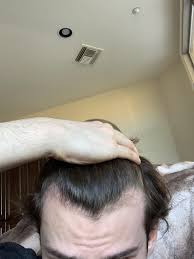 Please Help My Left Side Of My Hairline Match My Right One Hair Beauty Skin Deals Me Fashion Love Cute S Hairline Celebrity Hair Colors Please Help Me