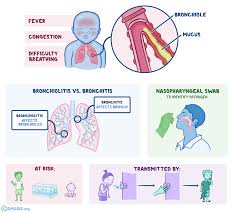 Maybe you would like to learn more about one of these? Bronchiolitis What Is It Transmission Symptoms Treatment And More Osmosis