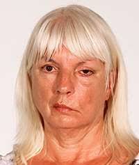 Smart specs to treat facial palsy, monitor mood and steer wheelchairs