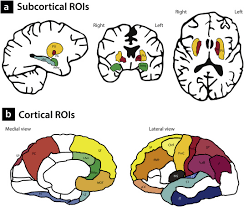 Image result for Cerebral Subcortex