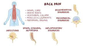 A person can take steps at home to ease the pain, and symptoms often. Lower Back Pain Clinical Practice Osmosis