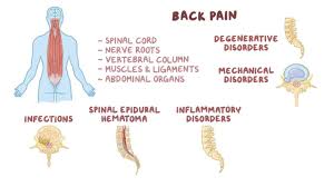 Left lower quadrant pain information including symptoms, diagnosis, treatment, causes, videos the area may be tender to the touch or the pain may be severe and the whole abdomen might be because left lower quadrant pain can be due to a serious disease, failure to seek treatment can result. Lower Back Pain Clinical Practice Osmosis