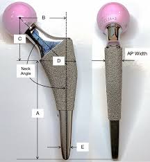 Schematic of femoral stem showing dimensions presented in ...