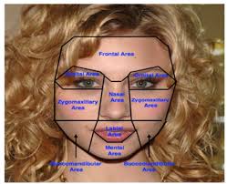 22: Asymmetric Mandibular Excess Growth Patterns | Pocket Dentistry