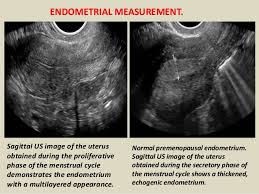 Ultrasound of the female pelvis is important for diagnostic accuracy. Presentation1 Pptx Ultrasound Examination Of The Uterus And Ovaries