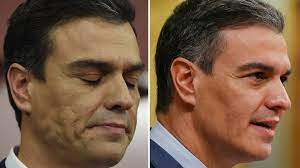 Los retoque estéticos de Pedro Sánchez: así ha cambiado su imagen en los  últimos años | Vozpópuli