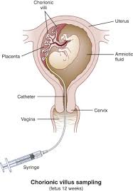 Image result for Endostemon villosus