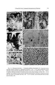 Image result for Heisteria zimmereri