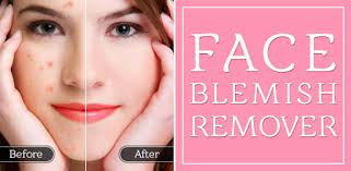 Adjust the size of a blue circle and place the center of the circle on the scar. Face Blemish Remover Smooth Skin Beautify Face Com Simplyentertaining Blemishremover Apk Aapks