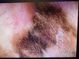 Macchie della Vulva: sono pericolose? Ecco un decalogo per orientarsi -  Latuapelle