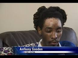 Victim in boiled water attacks fights to access money donated to GoFundMe