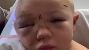 Fundraiser for Caleah Hindman by Sierra Petty : Coltyn and Caleah Hindman  injury fund