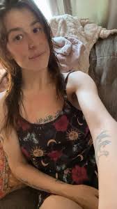 Best feeling after cast removal and surgery recovery