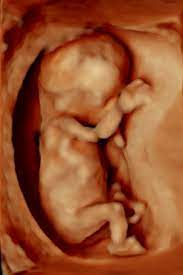 Bei der feindiagnostik wird das ungeborene mit einem besonders hochauflösenden ultraschallgerät ganz genau unter die lupe genommen. Zentrum Fur Pranataldiagnostik Und Humangenetik Kudamm 199