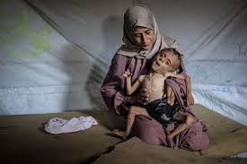La historia de la foto de Hedaya y su bebé, una de las imágenes más  impactantes de la hambruna en Gaza - BBC News Mundo