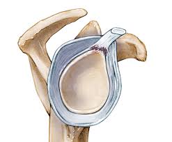 Image result for SLAP Lesion