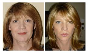 warning to those who are considering face exercises**