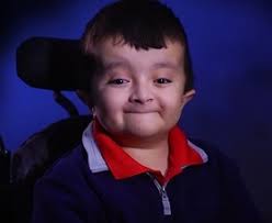 Care for children is usually provided until age 18, although in some cases, it may be extended to age 21. Shriners Hospital For Children Chicago Blog Teen In National Hospital Tv Commercials Has Dream