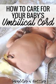 Any bleeding or discharge that persists should be evauated, as this is not a normal finding. How To Care For Your Baby S Umbilical Cord Swaddles N Bottles
