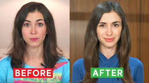 Bind to the receptors of steroid hormones that stunt hair growth. How I Stopped My Hair Loss What Worked For Me Youtube