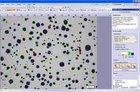 Cast Iron Analysis