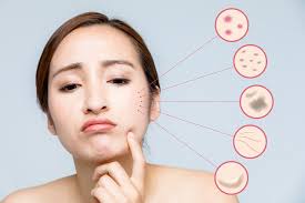 Pembersih muka secara teratur pergi melalui tatap mesin cuci minimal 4 kali sehari. 5 Tanda Skincare Tidak Cocok Dengan Kulitmu Okadoc