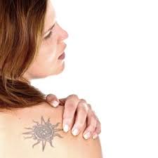 Do you think that the process of laser removal hurts more or less than that of a tattoo? Tattoo Removal Does It Hurt We Tell It Like It Is