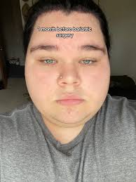 Gastric Sleeve Before and After 300 Lbs Men