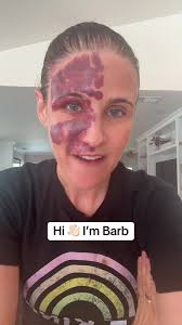 Barb Betts