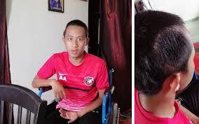 Herbal ini tanpa efek samping dan berkhasiat, dengan herbal ginkgo biloba plus capsule produk unggulan pt green world global, yang dapat mengatasi permasalahan penyakit peredaran darah termasuk darah beku dan tersumbat. Remaja Aktif Sukan Selamat Jalani Pembedahan Ke 2 Buang Darah Beku Di Kepala Remaja