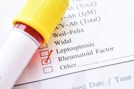 Image result for Rheumatoid Factor