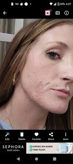 Effective face care product with before and after results