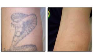 Offering a technique she calls nano color. 41 Concept Skin Tone Tattoo Cover Up Sleeve