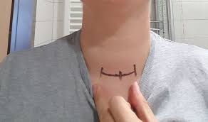 Je nach typ und größe werden bei dem eingriff auch die betroffenen lymphknoten am hals mit entfernt. Schilddrusen Op Entfernung Der Schilddruse Mein Erfahrungsbericht