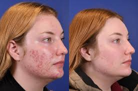 Mandi Robinson (@skinbymandi) • Instagram photos and videos