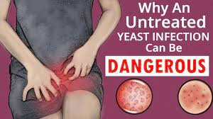 What Happens If A Yeast Infection Goes Untreated Find Out The Truth Youtube Yeast Infection Yeast Infection Pictures Yeast