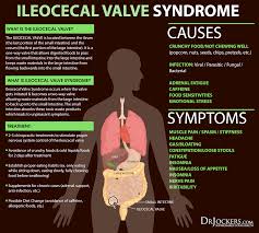 The Benefits Of Ileocecal Valve Massage Drjockers Com